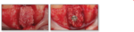 Lumina Bone Bloque - Imagen 5