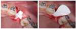 Lumina PTFE - Imagen 4